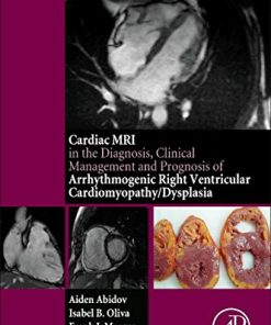 The Cardiac MRI in Diagnosis Clinical Management And Prognosis Of Arrhythmogenic Right Ventricular Cardiomyopathy Dysplasia