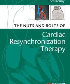 The Nuts and Bolts of Cardiac Resynchronization Therapy