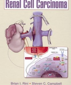 Renal Cell Carcinoma By Brian I Rini