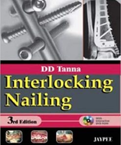 Interlocking Nailing 3rd Edition