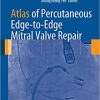 Atlas of Percutaneous Edge to Edge Mitral Valve Repair