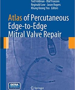 Atlas of Percutaneous Edge to Edge Mitral Valve Repair
