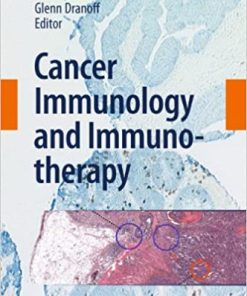 Cancer Immunology and Immunotherapy