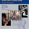 Vasculature Of The Brain And Cranial Base Variations in Clinical Anatomy 2nd Ed