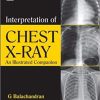 Interpretation of Chest X-Ray An Illustrated Companion