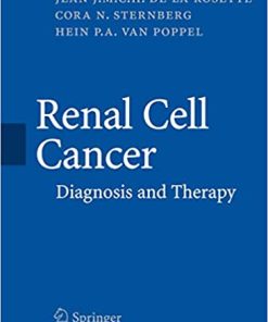 Renal Cell Cancer Diagnosis and Therapy