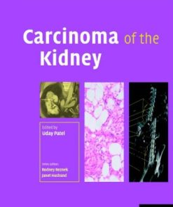 Carcinoma of the Kidney
