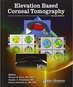 Elevation Based Corneal Tomography 2nd Edition