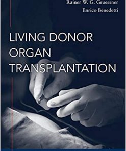 Living Donor Organ Transplantation
