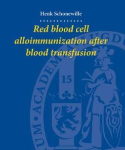 Red Blood Cell Alloimmunization after Blood Transfusion