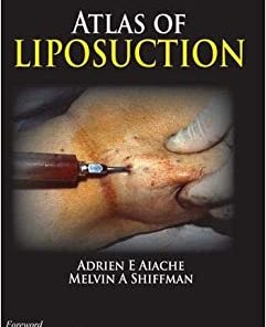 Atlas of Liposuction