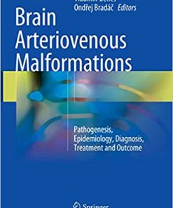 Brain Arteriovenous Malformations Pathogenesis Epidemiology Diagnosis Treatment and Outcome