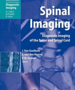 Spinal Imaging Diagnostic Imaging of the Spine and Spinal Cord