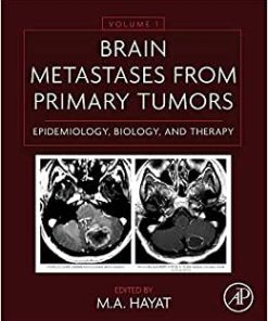 Brain Metastases from Primary Tumors Volume 1 Epidemiology Biology and Therapy
