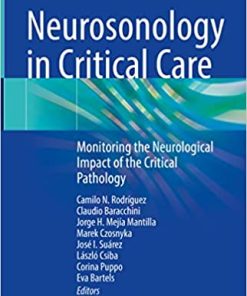 Neurosonology in Critical Care Monitoring the Neurological Impact of the Critical Pathology