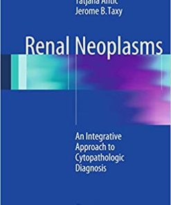 Renal Neoplasms An Integrative Approach To Cytopathologic Diagnosis