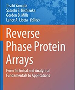 Reverse Phase Protein Arrays From Technical and Analytical Fundamentals to Applications