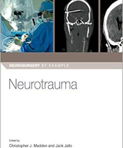 Neurotrauma