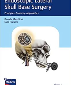 Endoscopic Lateral Skull Base Surgery Principles Anatomy Approaches