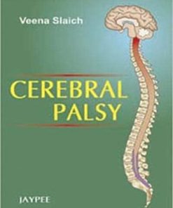 Cerebral Palsy