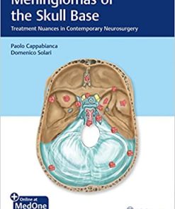 Meningiomas of the Skull Base Treatment Nuances in Contemporary Neurosurgery