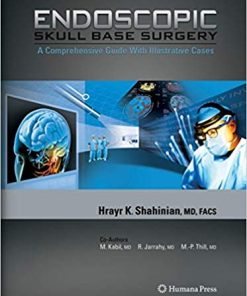 Endoscopic Skull Base Surgery A Comprehensive Guide with Illustrative Cases