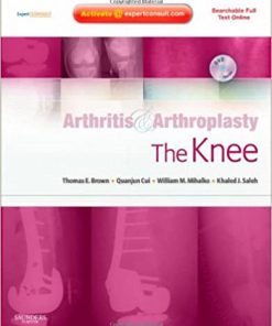Arthritis and Arthroplasty The Knee