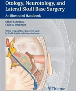 Otology Neurotology and Lateral Skull Base Surgery