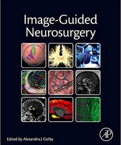 Image Guided Neurosurgery