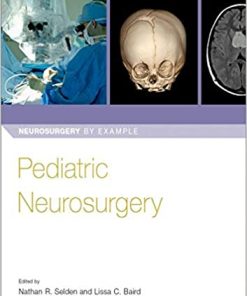Pediatric Neurosurgery