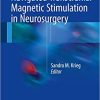 Navigated Transcranial Magnetic Stimulation in Neurosurgery
