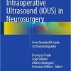 Intraoperative Ultrasound (IOUS) in Neurosurgery From Standard B Mode to Elastosonography