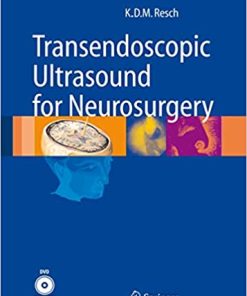 Transendoscopic Ultrasound for Neurosurgery