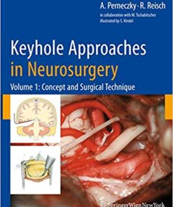 Keyhole Approaches in Neurosurgery Volume 1 Concept and Surgical Technique