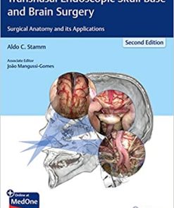 Transnasal Endoscopic Skull Base and Brain Surgery Surgical Anatomy and its Applications 2nd Ed