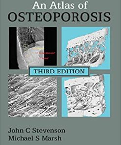 An Atlas of Osteoporosis 3rd Edition