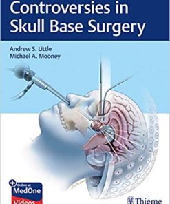 Controversies in Skull Base Surgery