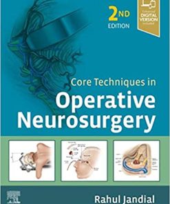 Core Techniques in Operative Neurosurgery 2nd Ed