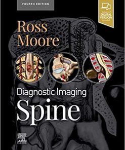 Diagnostic imaging Spine 4th Edition