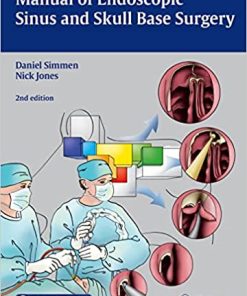 Manual of Endoscopic Sinus and Skull Base Surgery