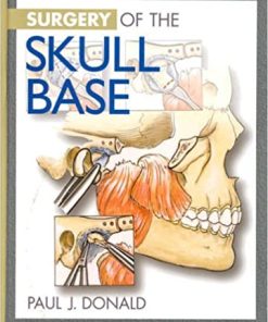 Surgery of the Skull Base By Paul J Donald