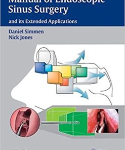 Manual of Endoscopic Sinus Surgery and Its Extended Applications