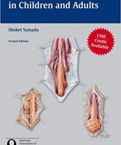 Tethered Cord Syndrome in Children and Adults