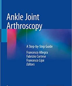 Ankle Joint Arthroscopy A Step by Step Guide