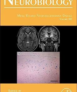 Metal Related Neurodegenerative Disease