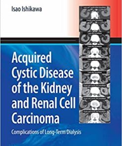Acquired Cystic Disease of the Kidney and Renal Cell Carcinoma