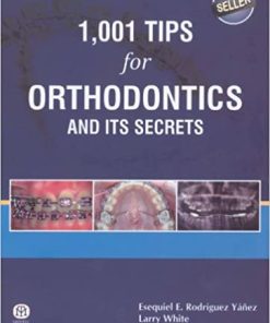 1001 Tips for Orthodontics and its Secrets
