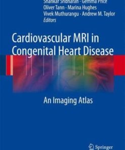 Cardiovascular MRI in Congenital Heart Disease