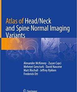 Atlas of Head Neck and Spine Normal Imaging Variants