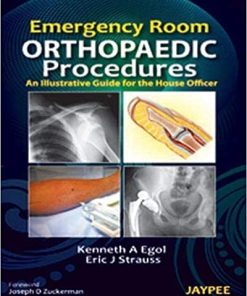Emergency Room Orthopaedic Procedures